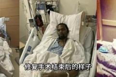 KD最奇！科比、杜兰特、塔图姆跟腱断裂修复手术结束后的样子
